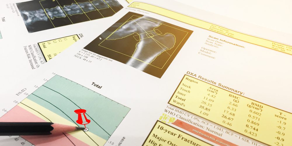 bone scan results