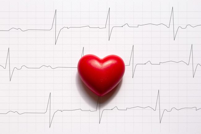 Heart diagram